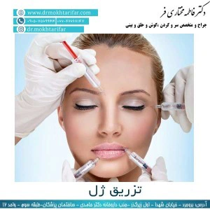 تزریق ژل به صورت در لرستان توسط دکتر فاطمه مختاری فر