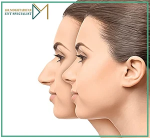 عوامل موثر بر هزینه عمل بینی چیست؟