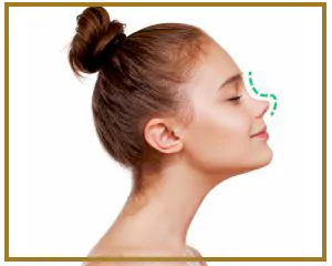 ویزگی بینی فانتزی چیست؟
