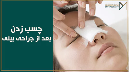 آیا چسب زدن بینی بعد از عمل بینی ضروری است؟