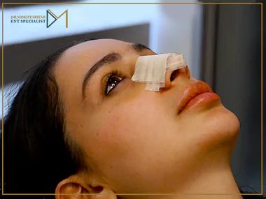 چرا بعد از جراحی بینی باید بینی را بچسبانیم؟