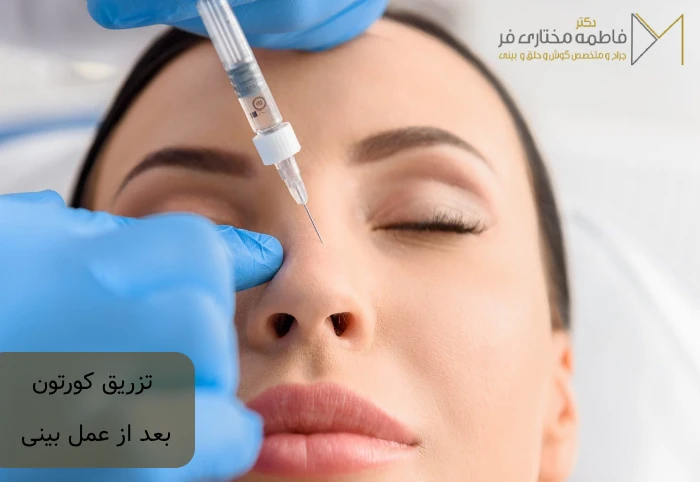 تزریق کورتون به بینی بعد از عمل