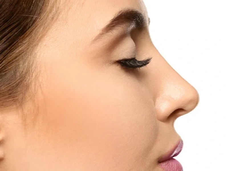 بهترین فرم بینی برای انواع صورت